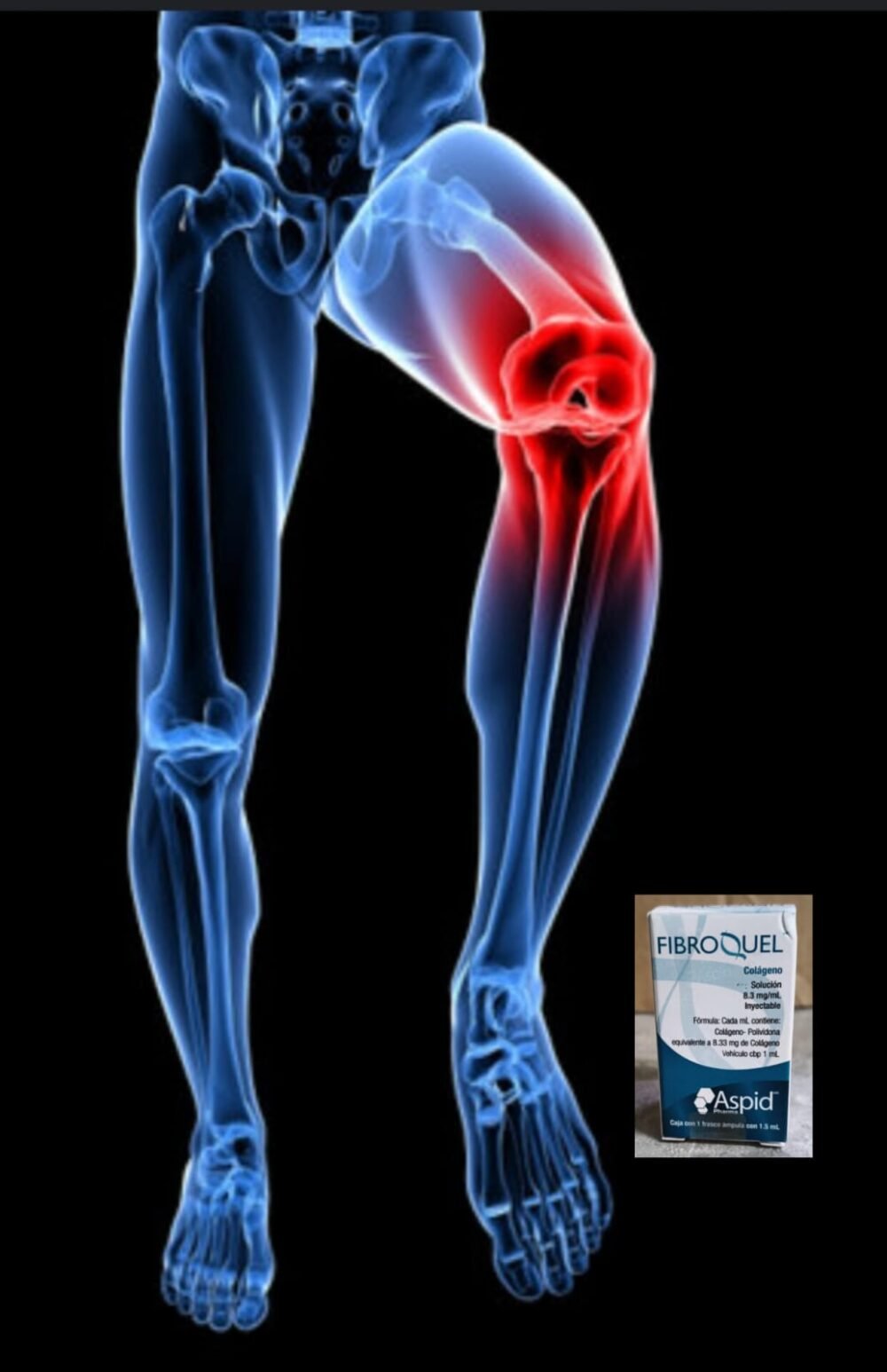 Fibroquel 1.5ml (colágeno) 3 pzs - Image 2